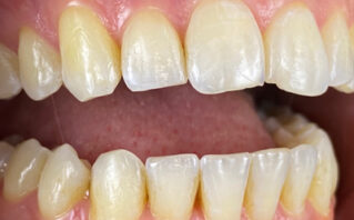 After - Westwood Dental Practice