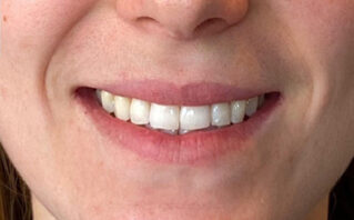 After - Westwood Dental Practice