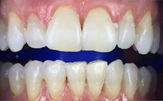 After - Westwood Dental Practice