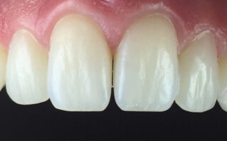 After - Westwood Dental Practice