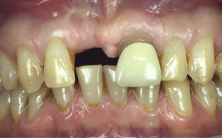 Before - Westwood Dental Practice