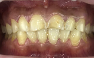 Before - Westwood Dental Practice