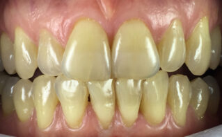 Before - Westwood Dental Practice