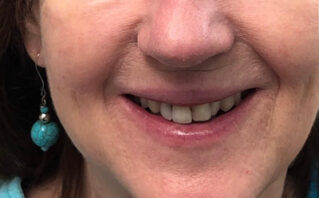Before - Westwood Dental Practice