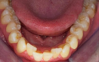 Before - Westwood Dental Practice