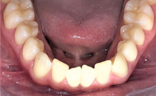 Before - Westwood Dental Practice