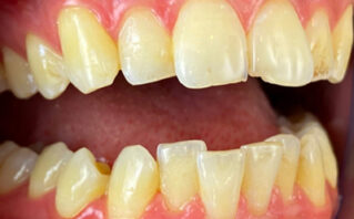 Before - Westwood Dental Practice