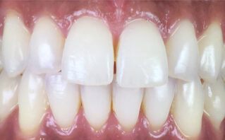 After - Westwood Dental Practice