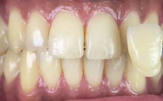 Before - Westwood Dental Practice