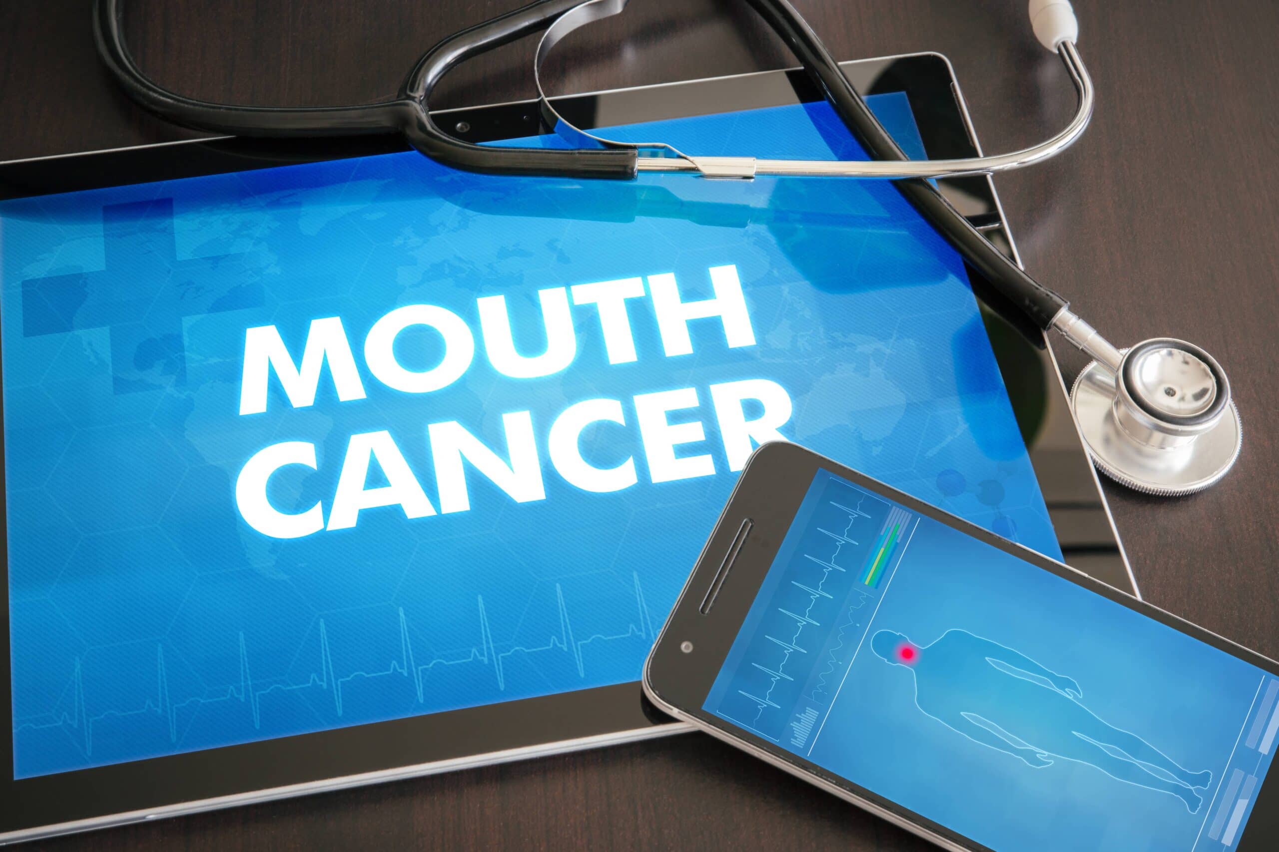 Mouth Cancer Screening Westwood Dental Dentist In Langley Berkshire